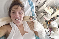El milagro de Paulina Biegun, la alpinista que sobrevivió a una caída de 650 metros en los Pirineos: "Me reventé de la mejor manera posible"
