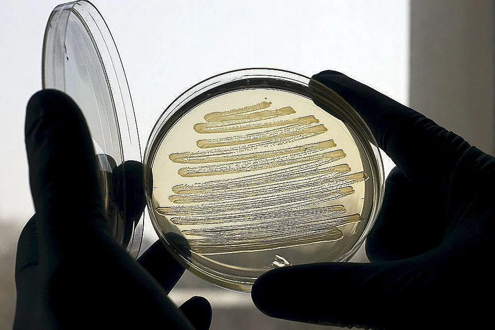 Primer caso de producción de paracetamol a partir de la bacteria  'Escherichia coli' utilizando una botella de plástico | Salud