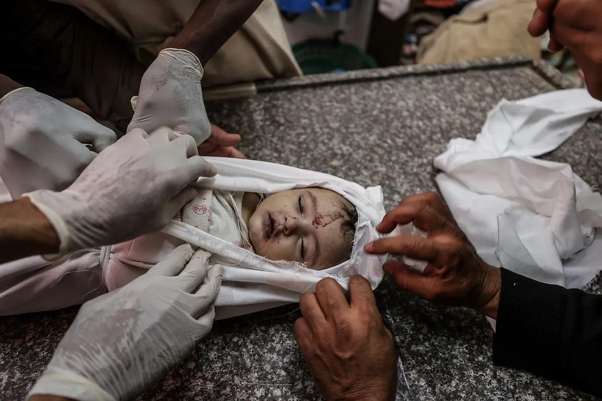 Gazze Kıtlık Tarafından Yüzyışı: BM, sonraki saatlerde 14.000 bebeğin öleceğine dair uyarıyor