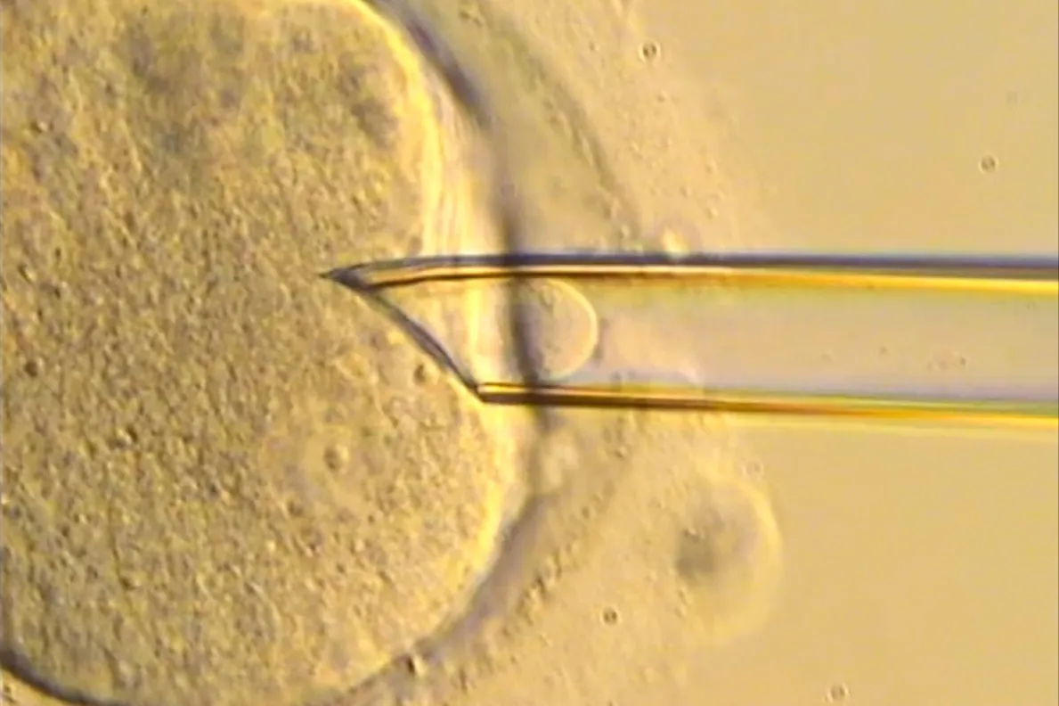 ¡Un Nuevo Amanecer para Bebés en Riesgo! Primeros Resultados Prometedores de Tecnología Innovadora Contra Enfermedades Mitocondriales
