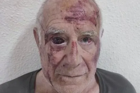Detienen en Francia a uno de los implicados en la agresión de Torre Pacheco (Murcia)