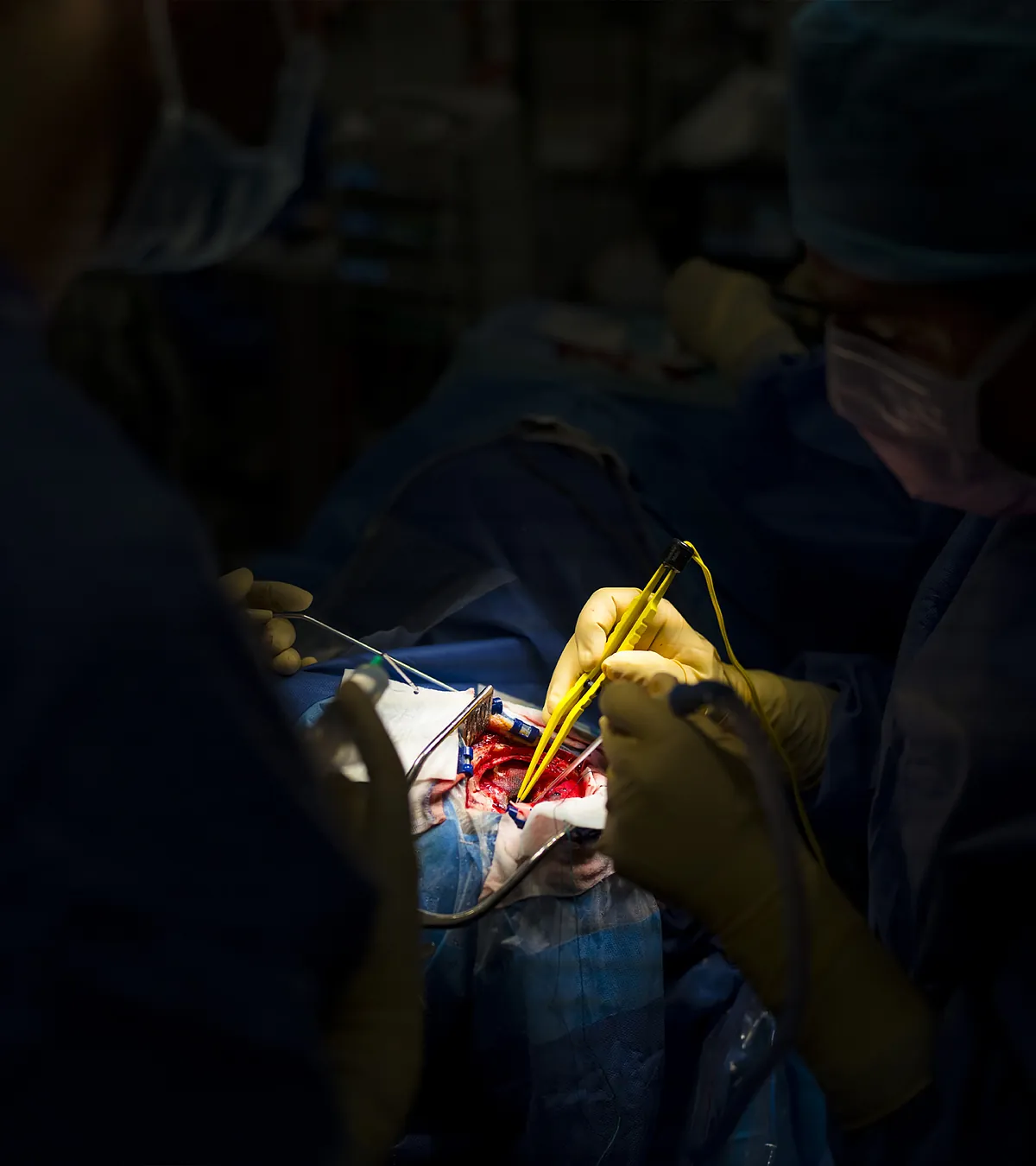 Así luchan contra el cáncer la metástasis de Pepe y de otros 400 españoles:  Los tumores llegan vivos al laboratorio 