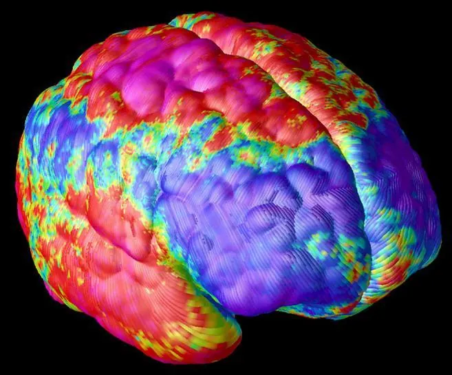 Investigadores de la Universidad de Sevilla identifican las zonas cerebrales más afectadas en las etapas iniciales de la esquizofrenia
