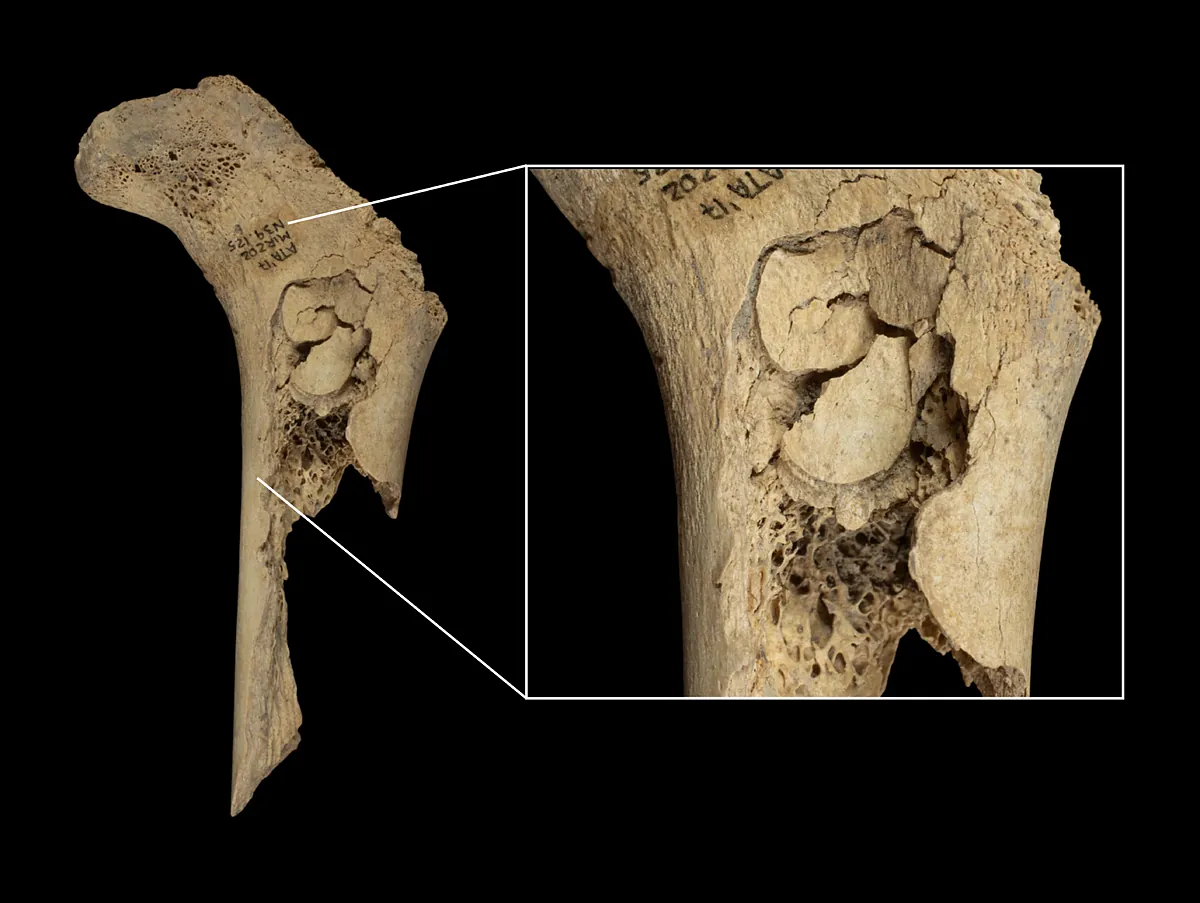 Nuevo caso de canibalismo humano en Atapuerca: 11 personas fueron descuartizadas, cocinadas y devoradas hace 5.700 años