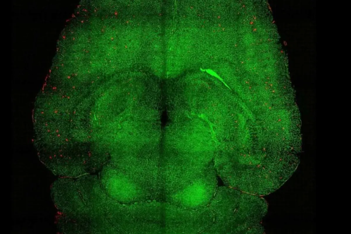 Consiguen revertir el Alzheimer el equivalente a 20 años humanos usando nanopartículas